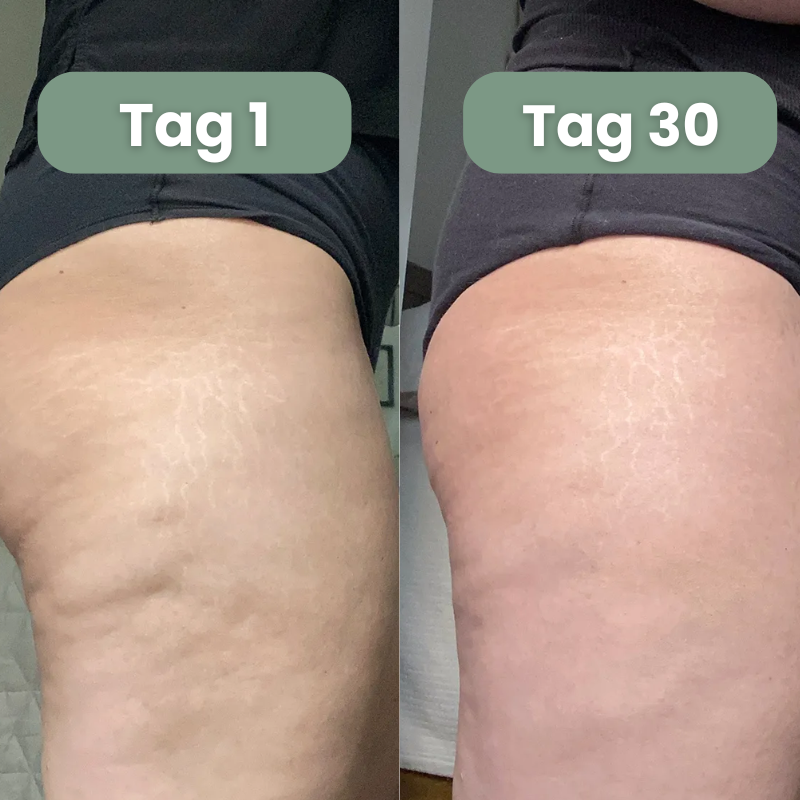 SlimRoll Pro - Massageroller
