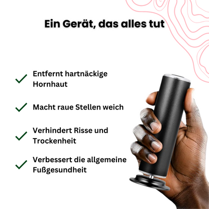 SmoothSole - Elektrischer Hornhautentferner